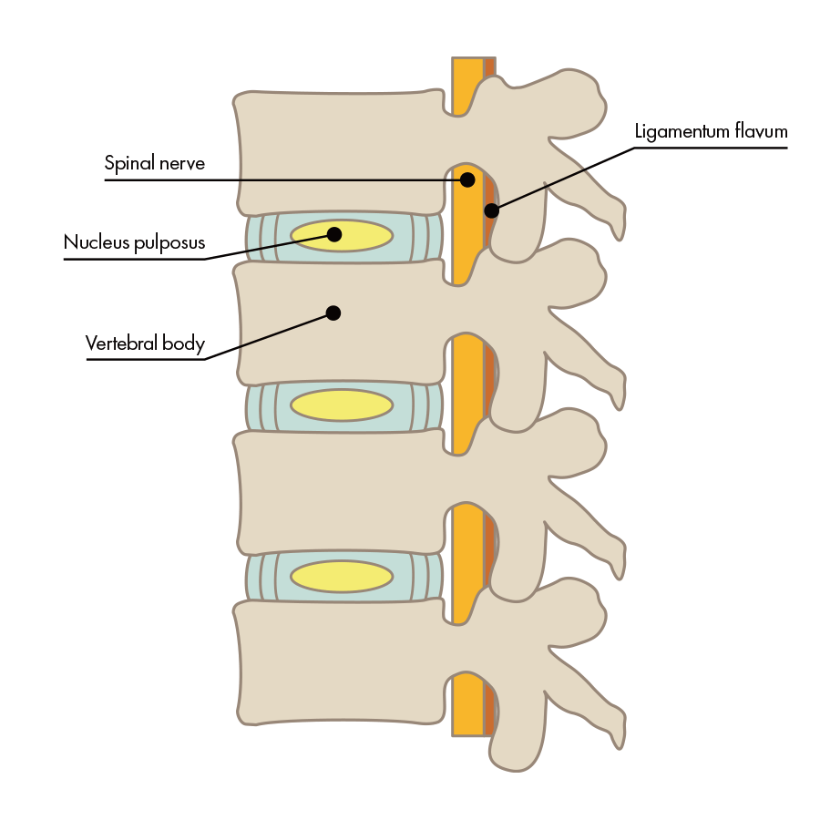 Normal intervertebral disc(Side)