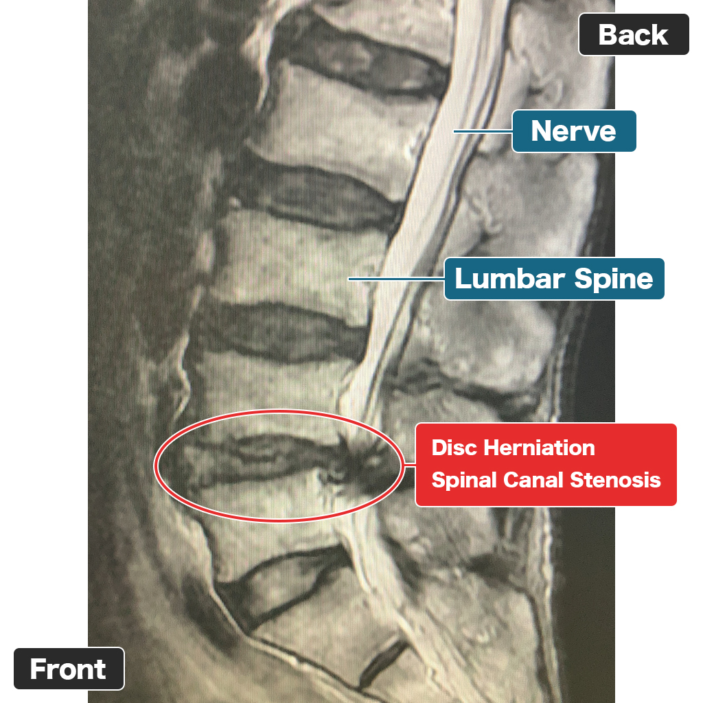 MRI