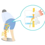 When you suffer from sciatica, you may feel pain in your calves and the back of your thighs! ? A summary of the characteristics and treatment methods for sciatica.