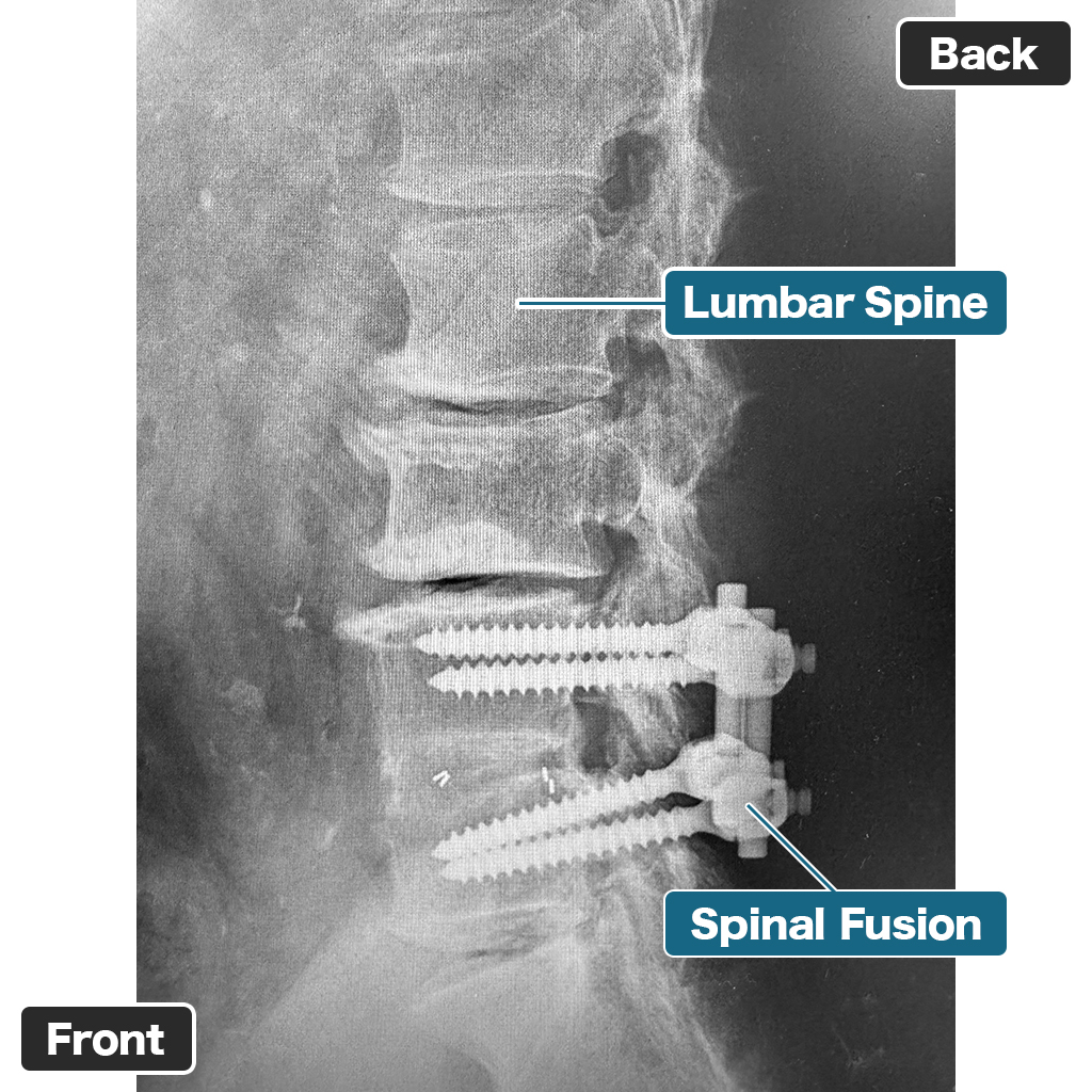 X-ray