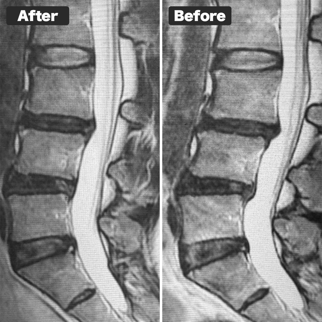 MRI photo
