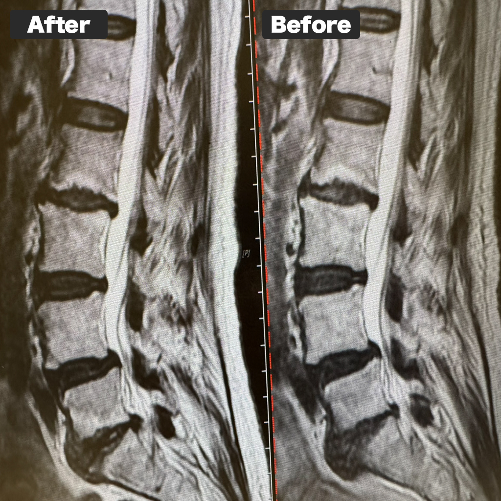 MRI Photo