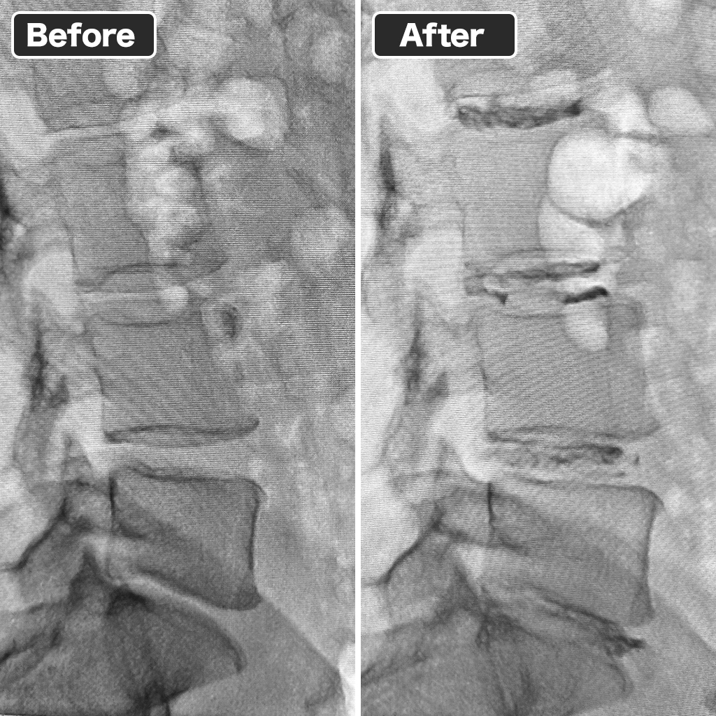 Pre and Post-Treatment X-rays