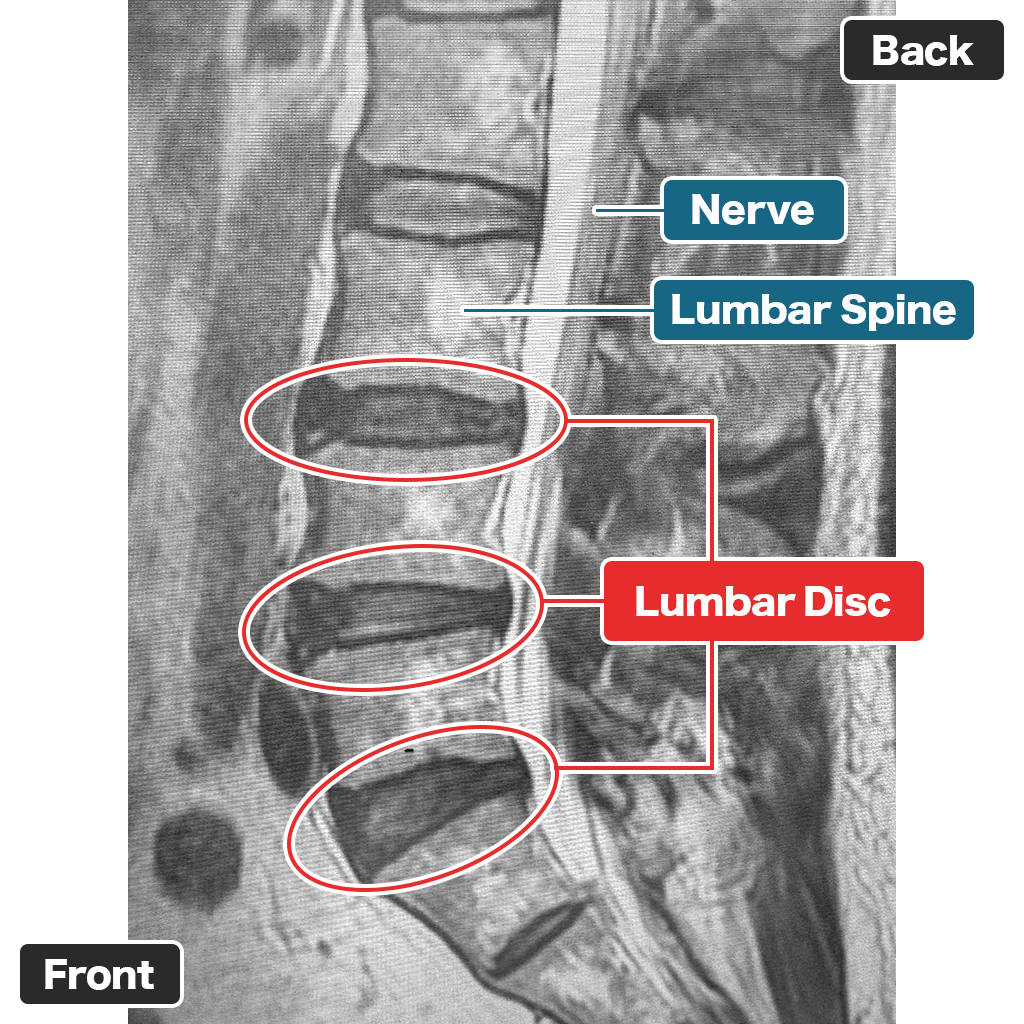 MRI Examination