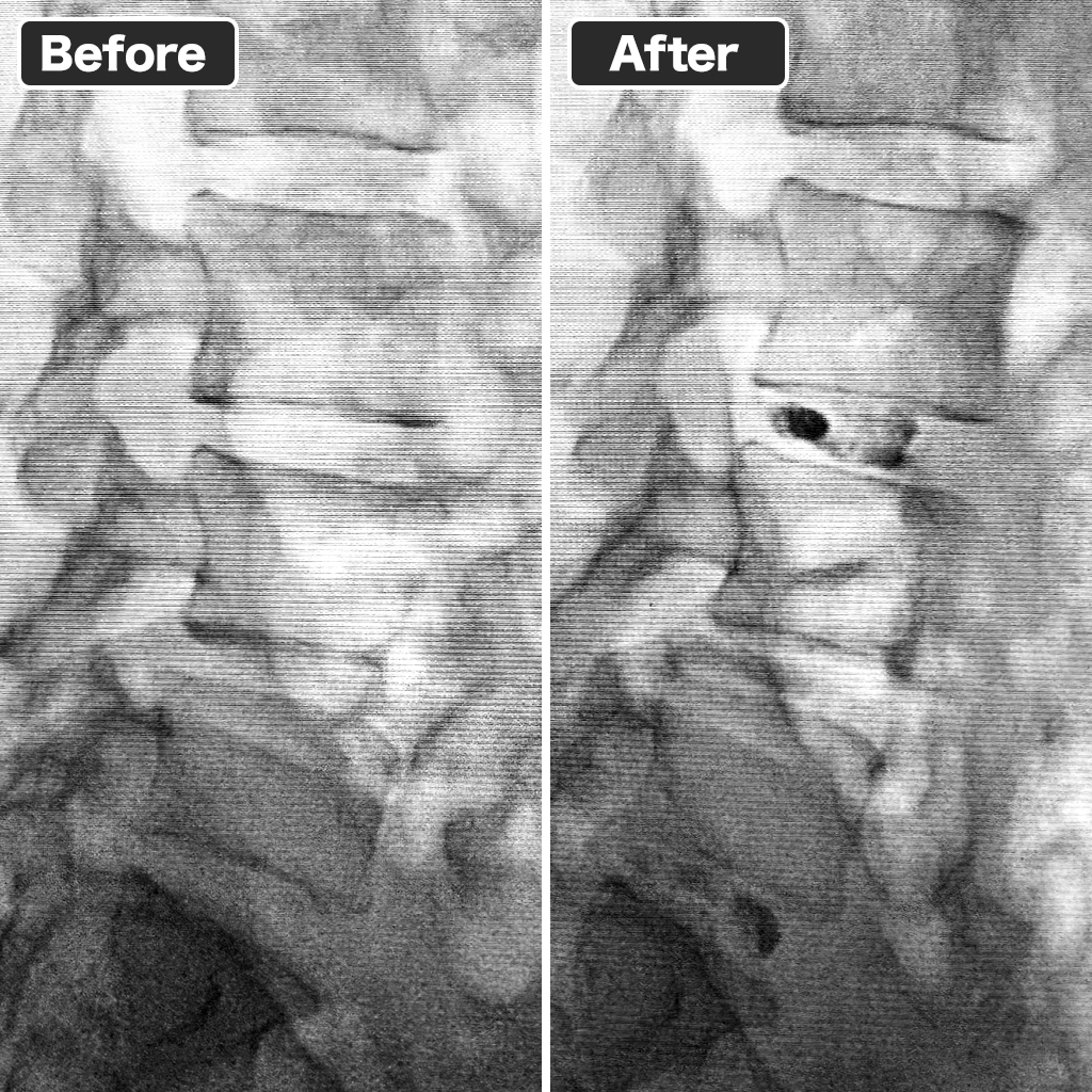 Pre- and Post-Treatment X-rays