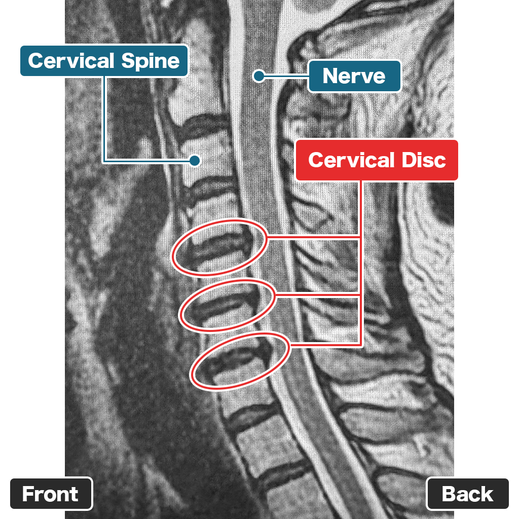 Pemeriksaan MRI