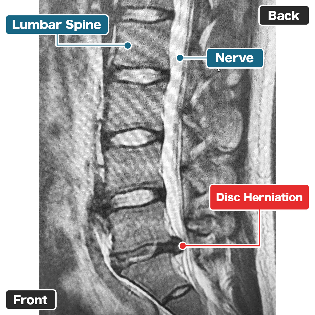 MRI Examination